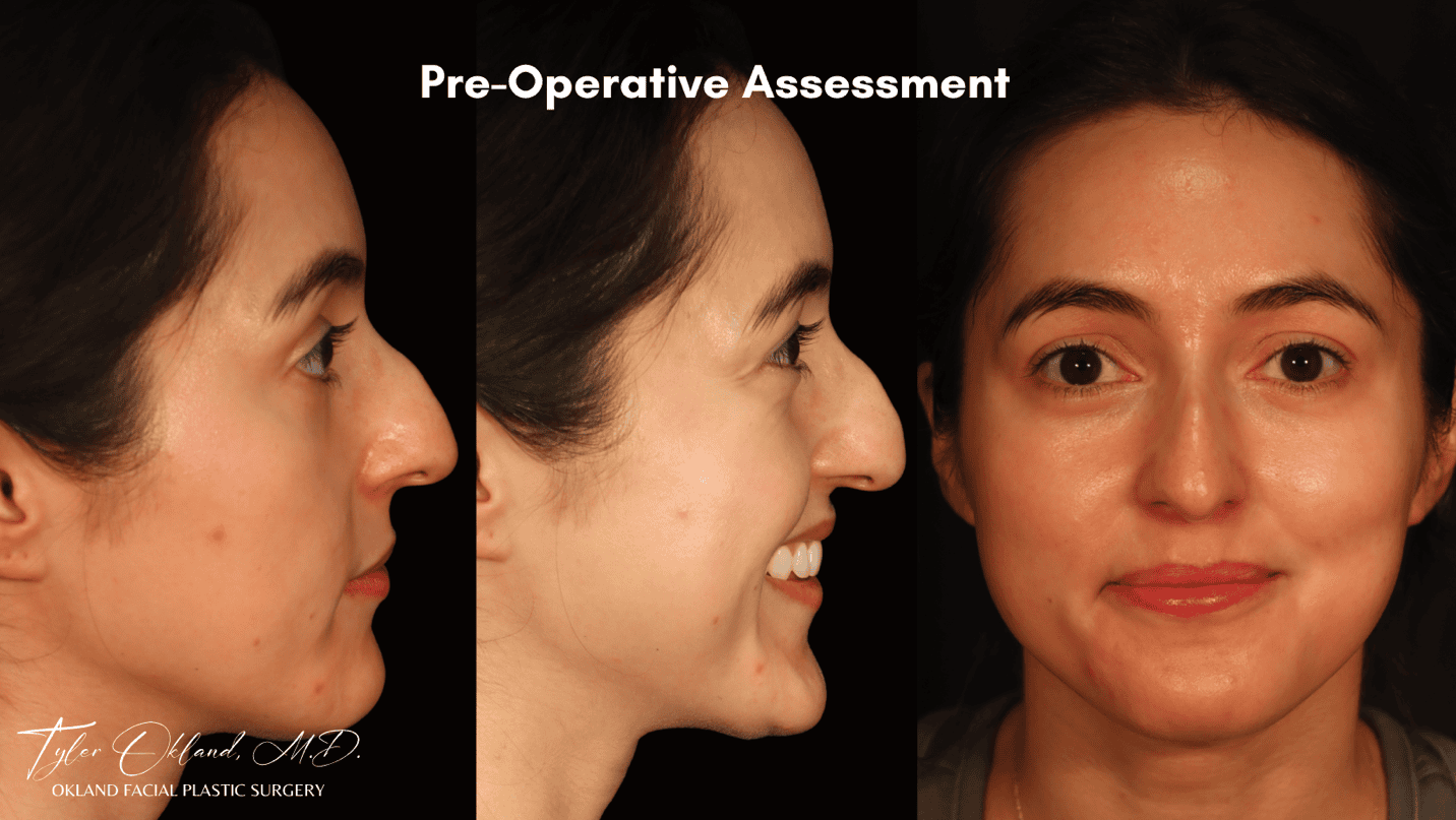 Case 01 preoperative photographs