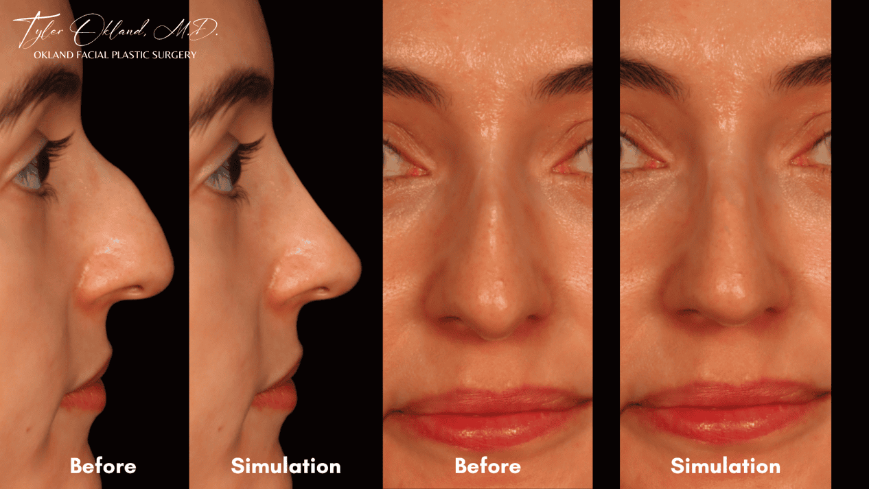 Case 01 consultation simulation detail