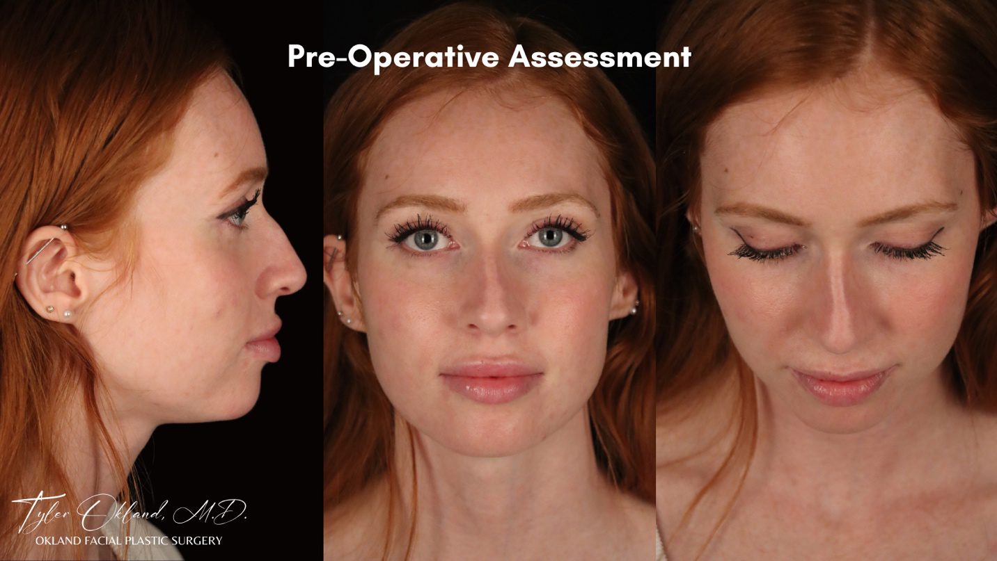 Case 02 preoperative photographs