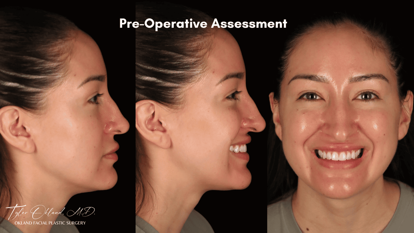 Case 03 preoperative photographs