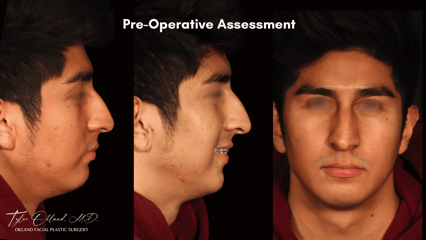 Case 04 preoperative photographs