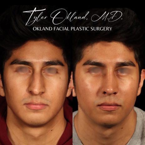 Case 04 matched frontal view