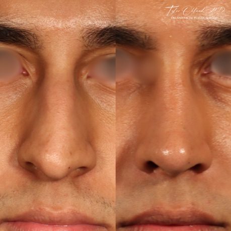 Case 04 centered frontal detail