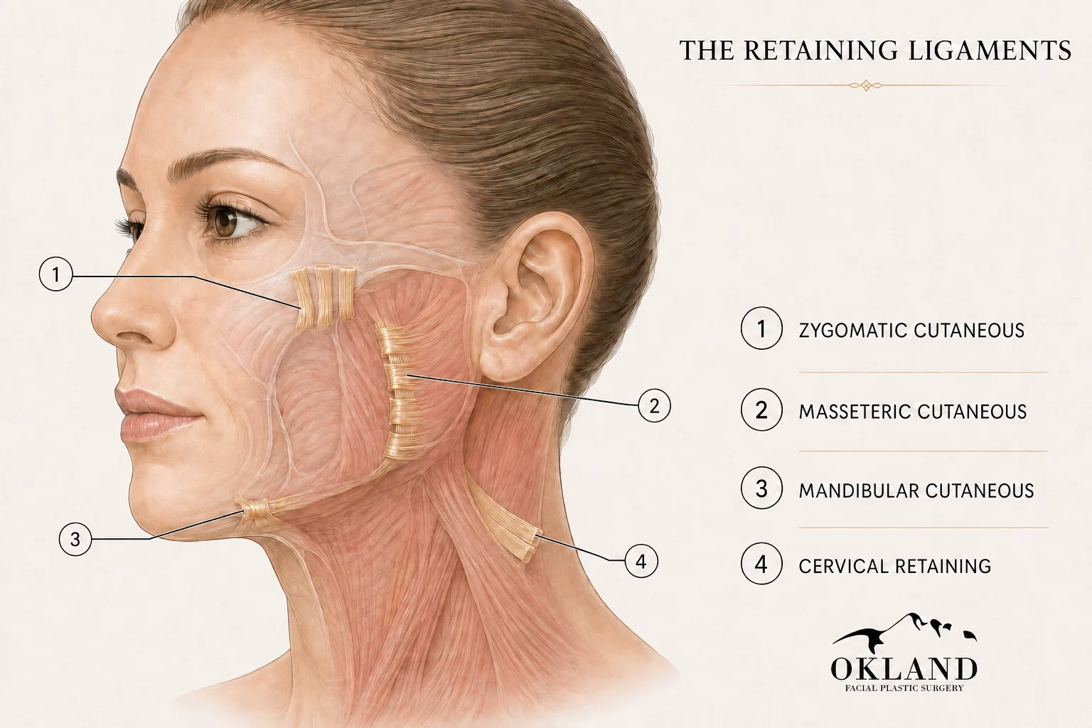 Medical illustration identifying facial retaining ligaments relevant to deep plane facelift surgery.
